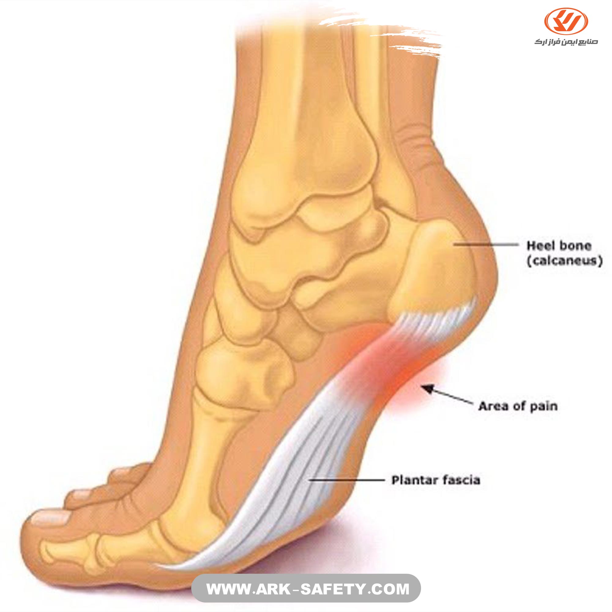 imflammation-of-fasciitis